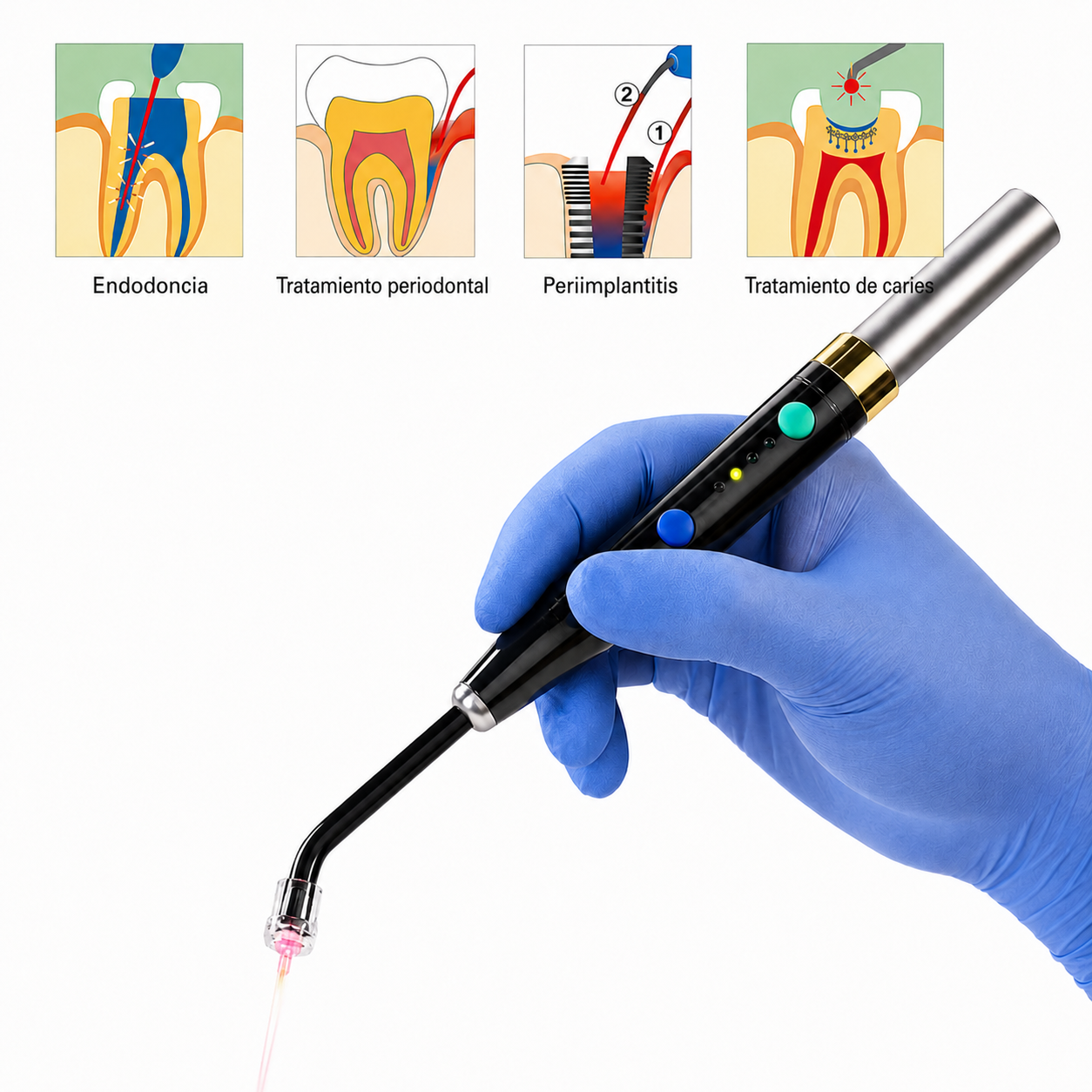 Láser de Diodo Dental Inalámbrico para Tejidos Blandos | 3D Dream